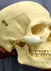 Photo of skull to highlight the optimal position of a malar implant